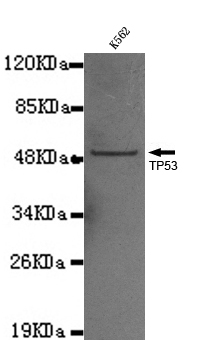 P53 Monoclonal Antibody