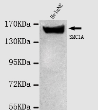 SMC1A(N-term) Monoclonal Antibody