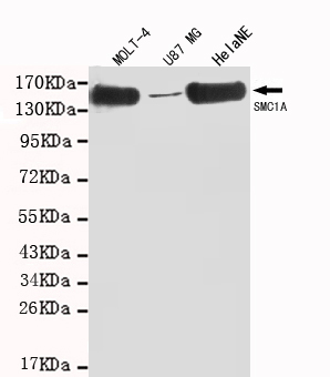 SMC1A(C-term) Monoclonal Antibody