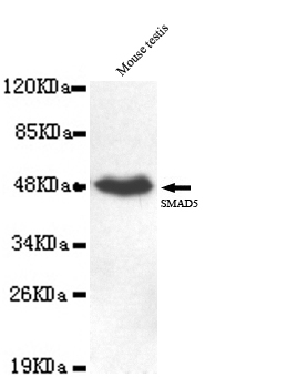 SMAD5(C-term) Monoclonal Antibody - SAB | Signalway Antibody