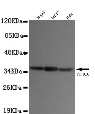 PP1A(N-term) Monoclonal Antibody
