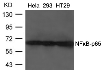 NFkB-p65(Ab-468) Antibody