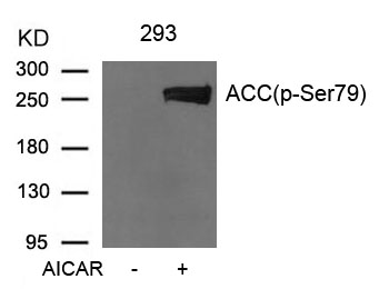 Acetyl-CoA Carboxylase (Phospho-Ser79)  Antibody