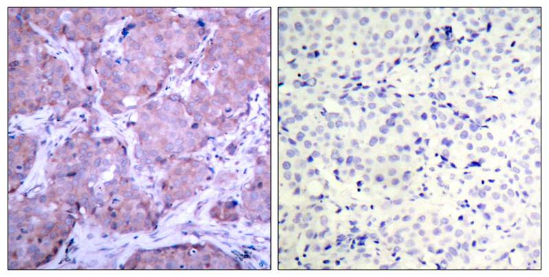 PTEN(Phospho-Ser380) Antibody