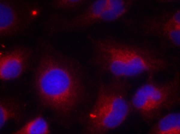 PTEN(Phospho-Ser380) Antibody