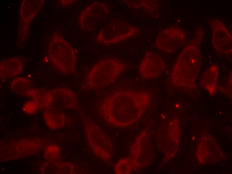 NFκB-p65(Phospho-Ser468) Antibody