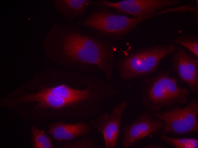 NFκB-p100/p52(Phospho-Ser870) Antibody