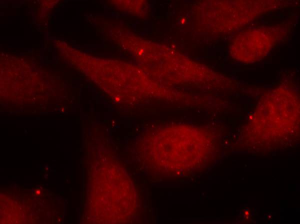 c-Abl(Phospho-Tyr412) Antibody