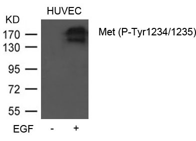 Met (Phospho-Tyr1234/1235) Antibody