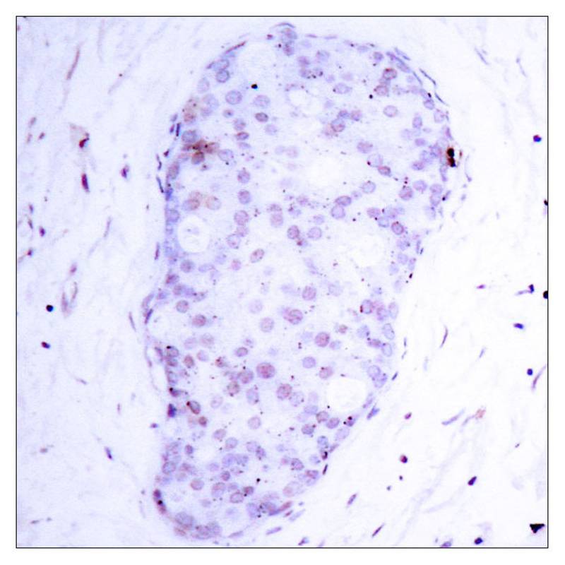 NFκB-p105/p50(Phospho-Ser907) Antibody