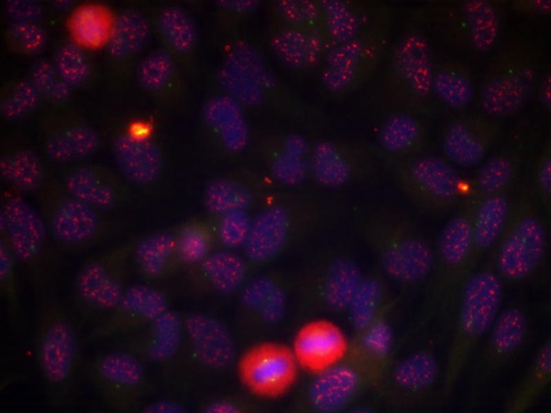 Elk1(Phospho-Thr417) Antibody