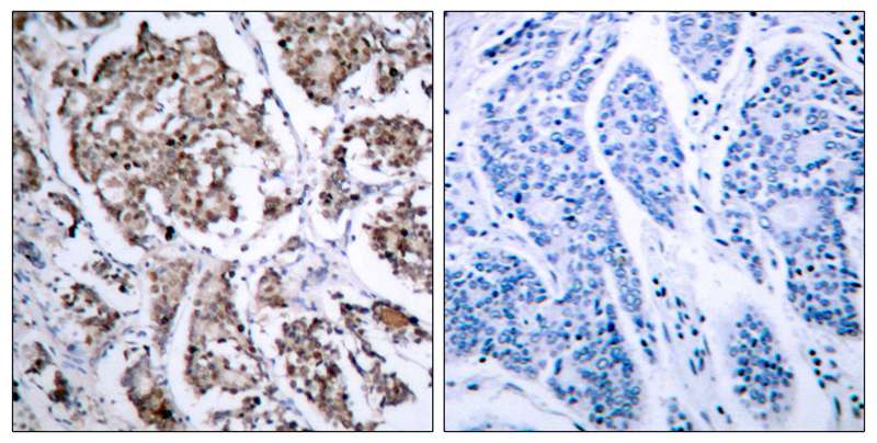 BAD(Phospho-Ser155) Antibody