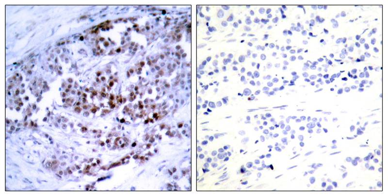 BCL-2(Phospho-Ser70) Antibody