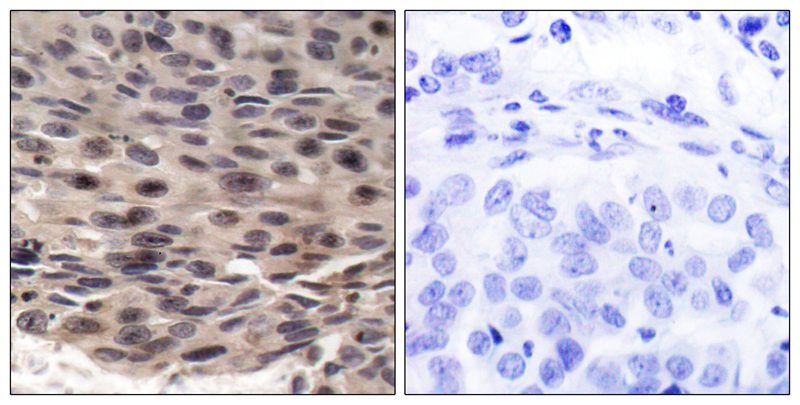 4E-BP1(Phospho-Thr37) Antibody