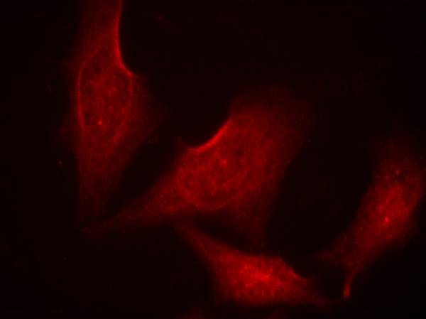 NFκB-p65 (phospho-Ser311) Antibody