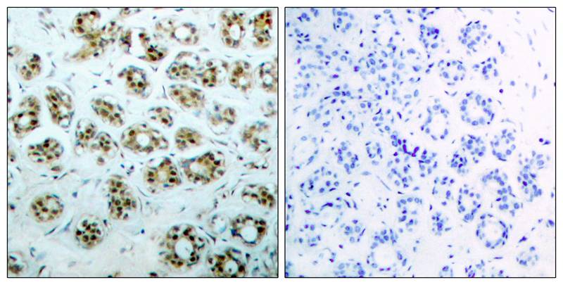 NFκB-p65 (phospho-Ser311) Antibody