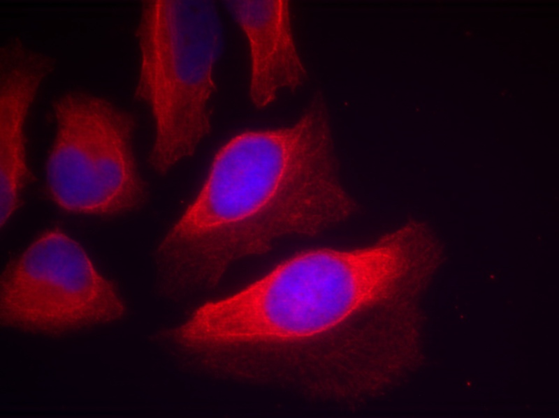 IKK-β(Phospho-Tyr199) Antibody