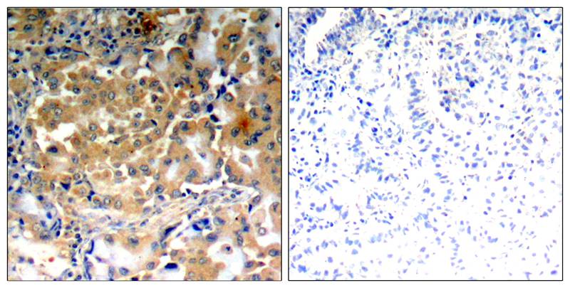 PKCζ(Phospho-Thr410) Antibody