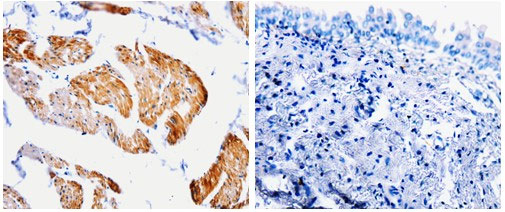 CASP2 Antibody