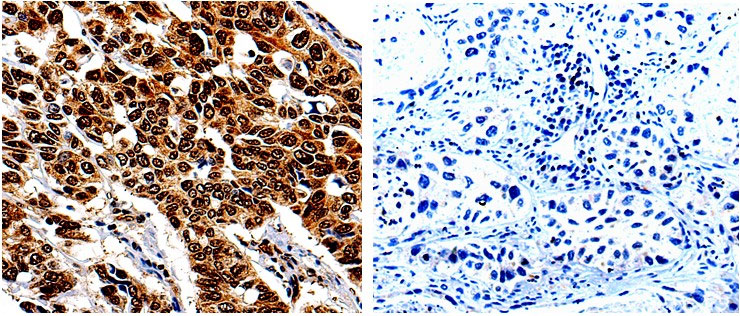 IL13RA1 Antibody