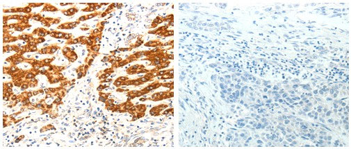 AIFM1 Antibody