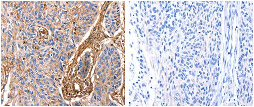 ANXA6 Antibody