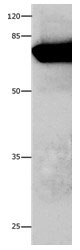 ANXA6 Antibody