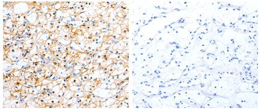 TTR Antibody