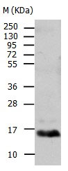 TTR Antibody