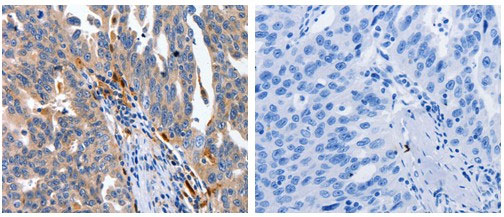 IL18 Antibody