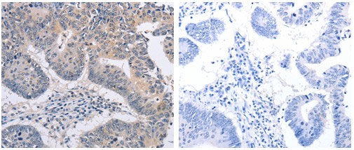 FBXO32 Antibody