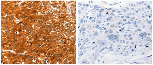SERPINB5 Antibody