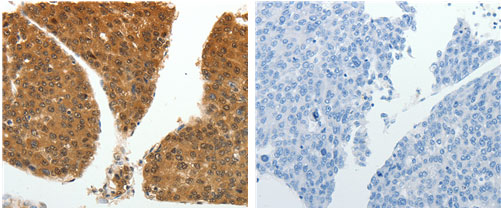 PSMD14 Antibody