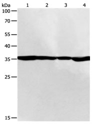 PSMD14 Antibody