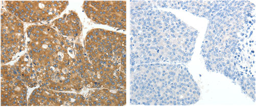 RPLP0 Antibody