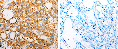 ARF1 Antibody