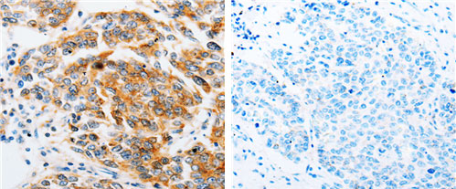 ARF6 Antibody