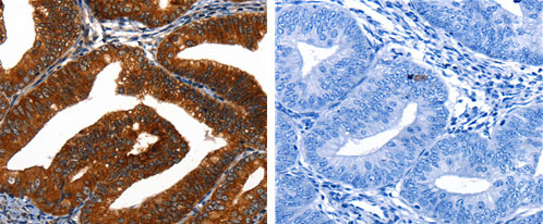 KRT16 Antibody