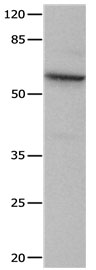 CRMP1 Antibody
