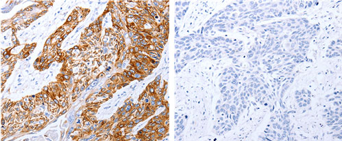 GRPR Antibody