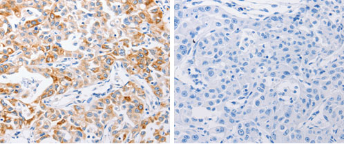 MMP10 Antibody