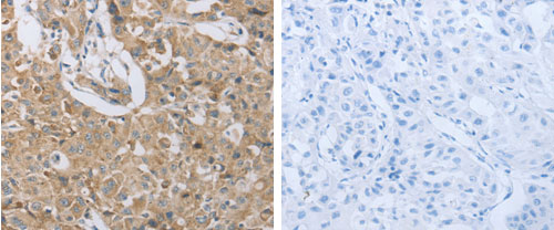 P2RY12 Antibody