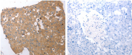 SIRT5 Antibody