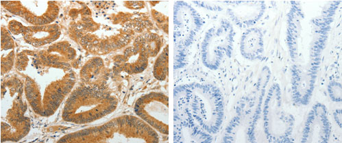 AKR1C1 Antibody