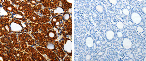 TXN Antibody