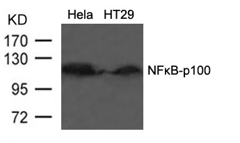 NFkB-p100(Ab-866) Antibody