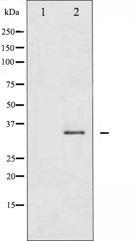 FOS B antibody