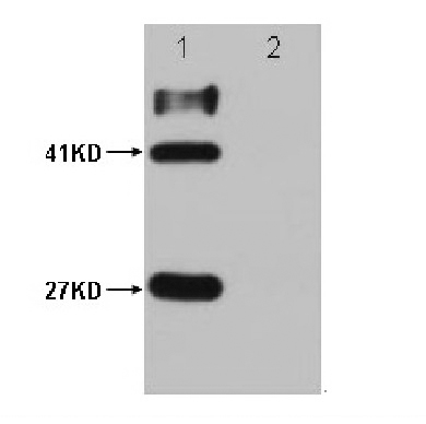 HSV-Tag Mouse Monoclonal Antibody