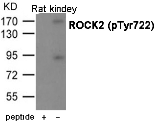 ROCK2 (Phospho-Tyr722) antibody
