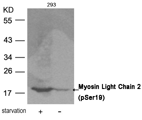 Myosin Light Chain 2 (Phospho-Ser19) Antibody
